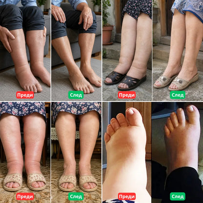 NuroBalm 1+1